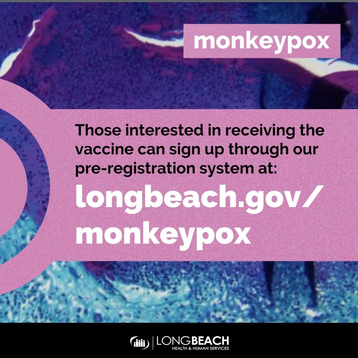 monkeypox